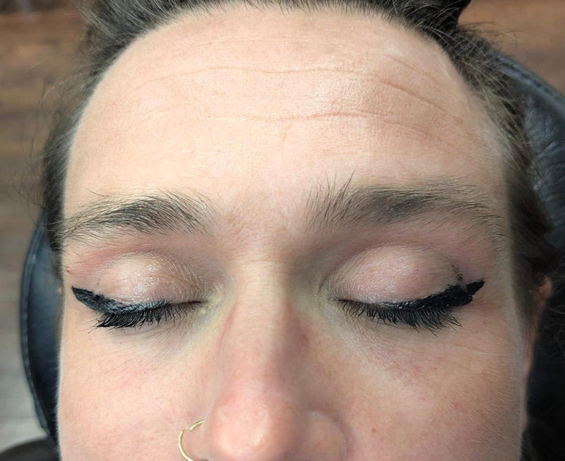 Before image