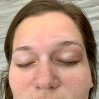 Transformation 3 thumbnail